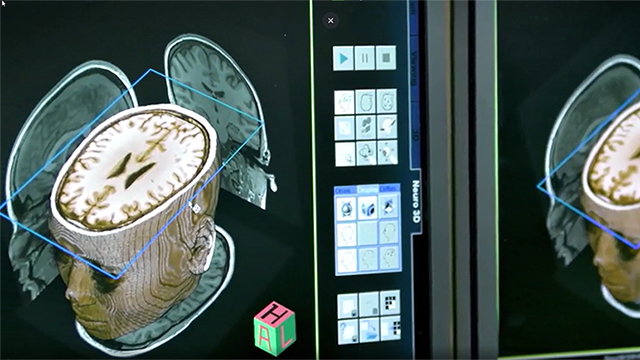3D sken mozku na monitoru počítače
