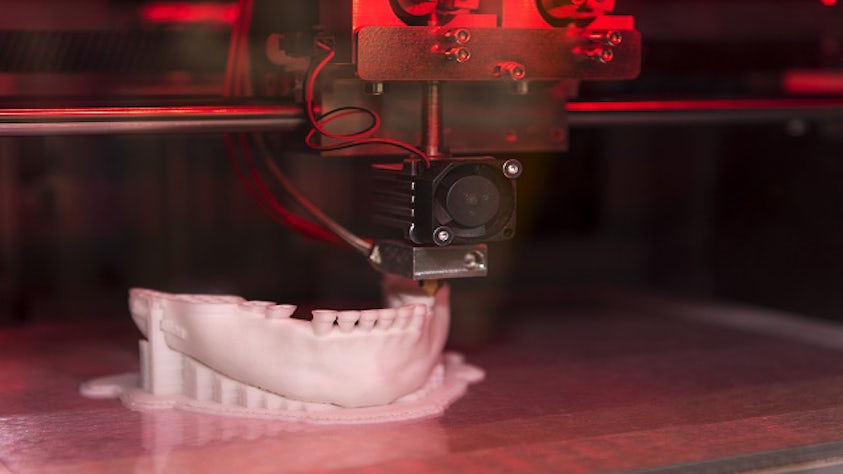 A photograph of a lower human jaw being 3D printed.