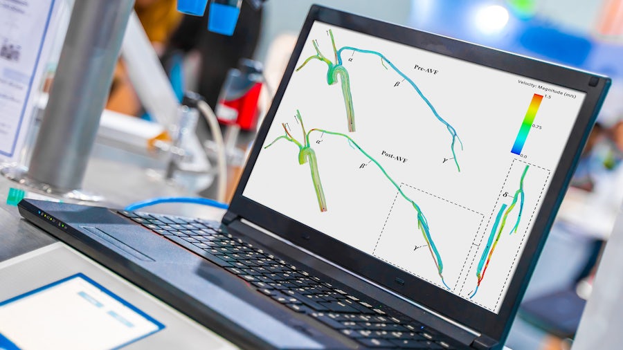 Using hemodynamic modeling to improve dialysis patients’ chances of success