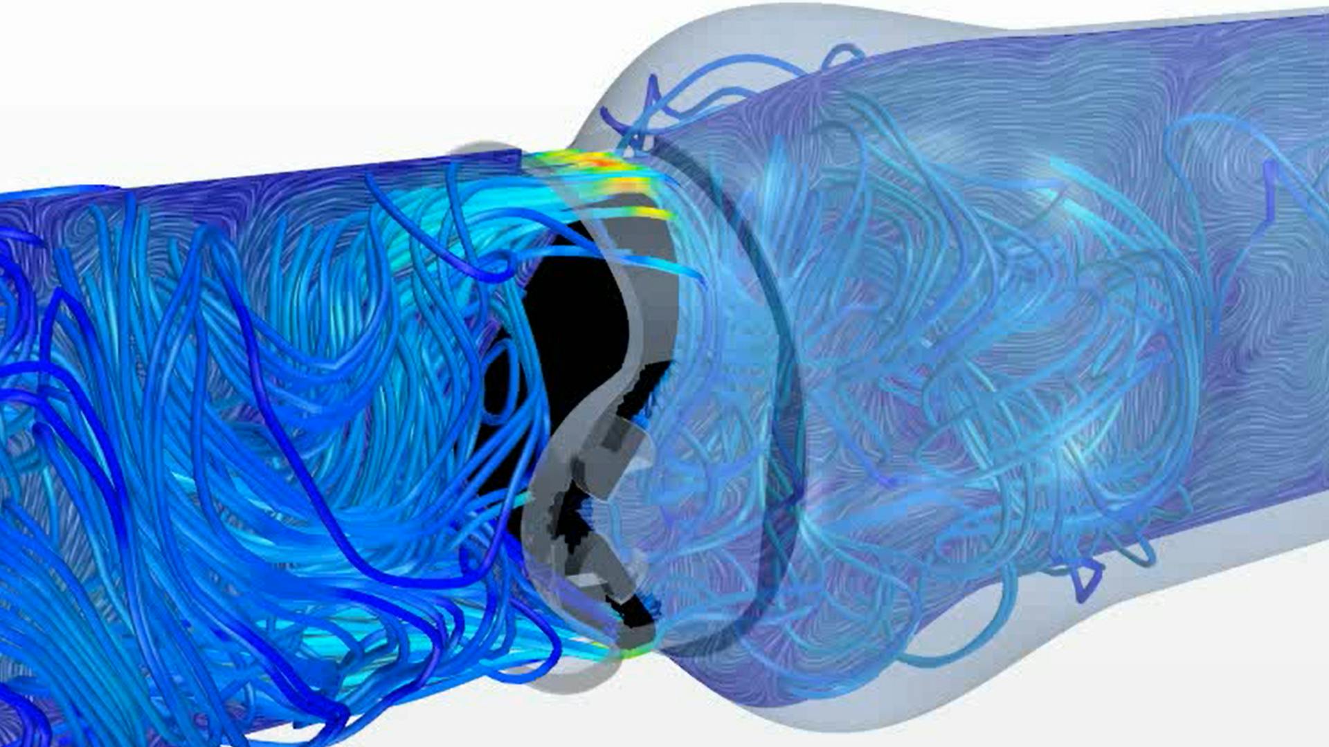 Revealing the details of blood flow through mechanical heart valves with CFD simulation