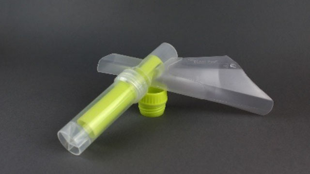 Ze vzorku moči lze zjistit mnoho onemocnění.