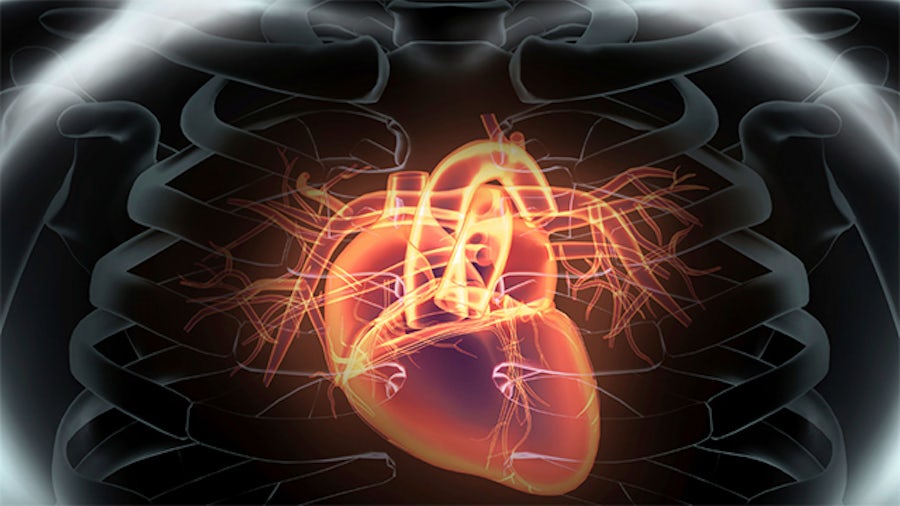 Image of chest x-ray with beating heart