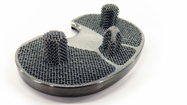 Společnost LimaCorporate využívá ekosystém softwaru NX AM a Siemens ke snížení počtu opakování návrhu, omezení chyb a zvýšení spolehlivosti.