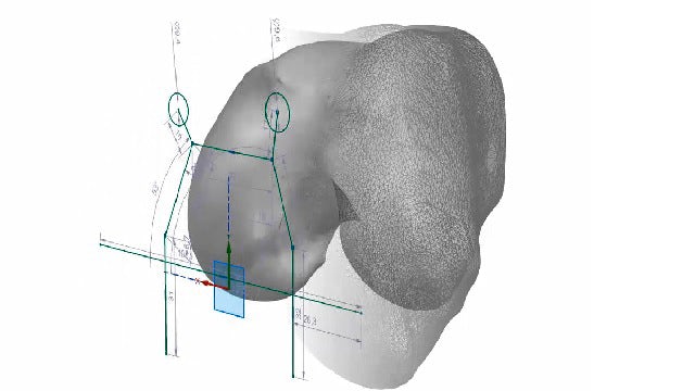 A medically scanned knee joint imported in to NX as a grey facet body, together with a dimensioned NX sketch profile