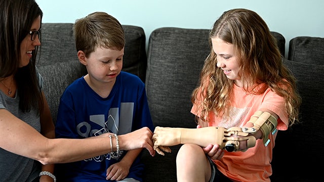 Unlimited tomorrow prosthetic arm patient.