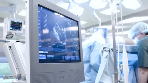 Ultraschallbild auf einem Computerbildschirm, während ein Arzt im OP operiert