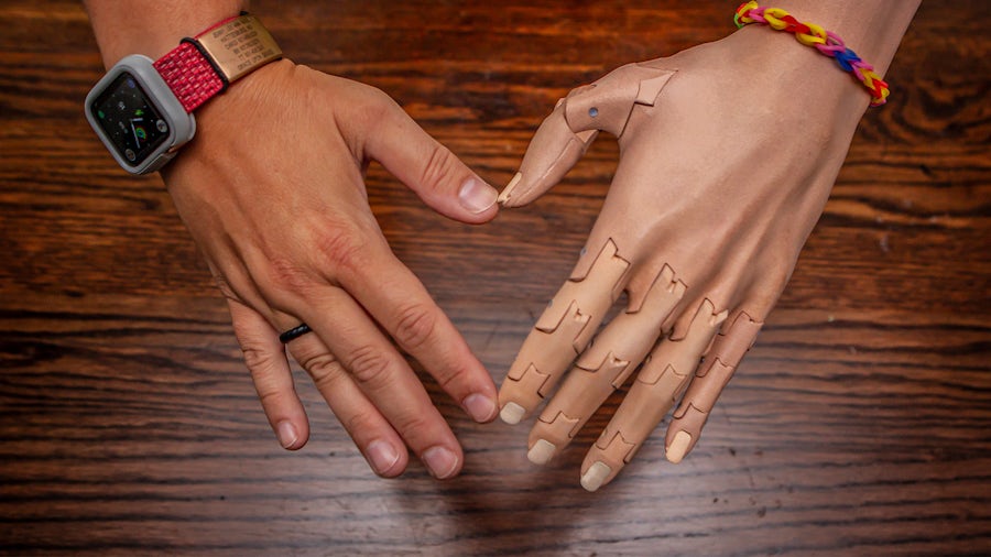 Two hands are making a heart image, and one of the arms is a prosthetic and designed using additive manufacturing.