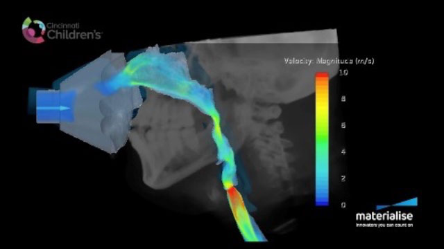 Může simulace pomoci lékařům určit, které zákroky by byly pro jednotlivé pacienty nejpřínosnější?